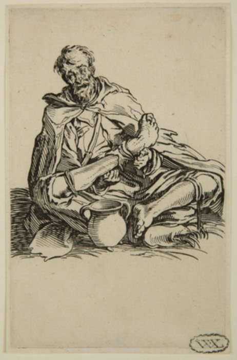 Print by Jacques Callot: Le Malingreux (The Sickly Beggar), represented by Childs Gallery